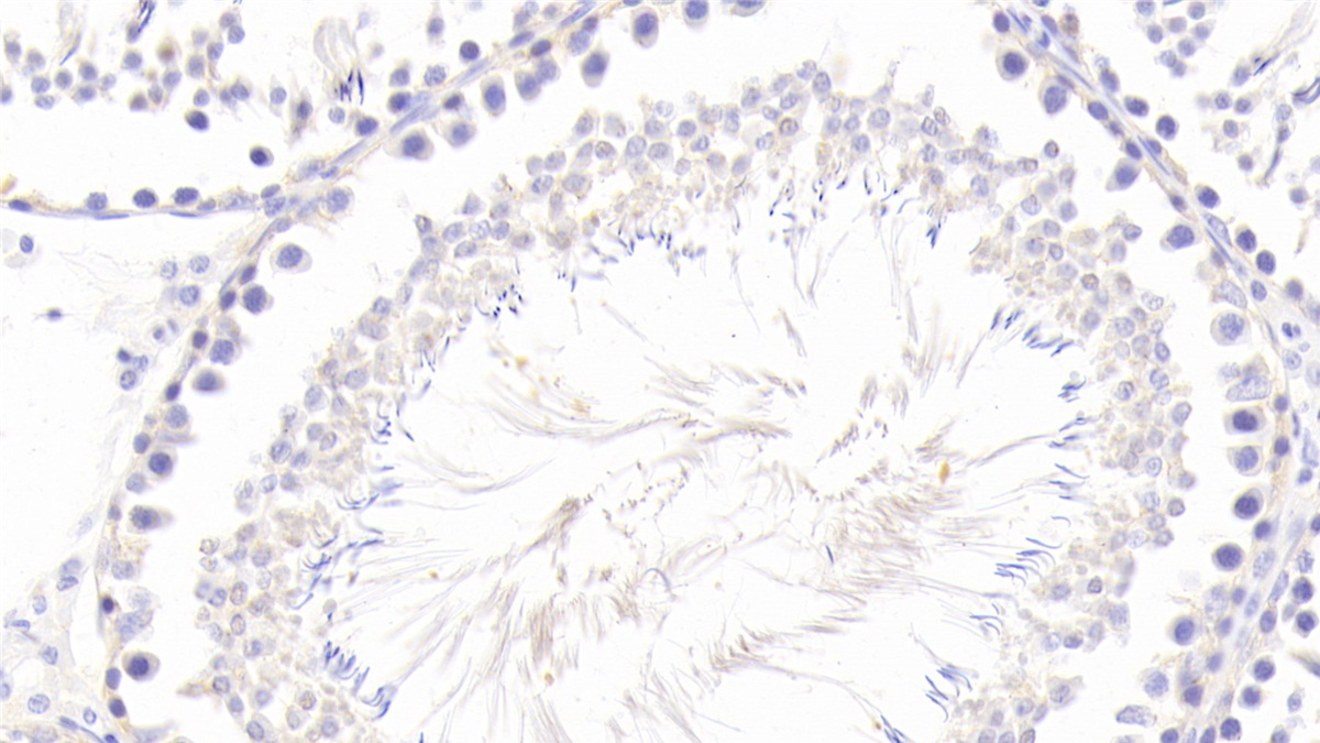 Polyclonal Antibody to Inhibitor Of Nuclear Factor Kappa B Kinase Interacting Protein (IKBIP)