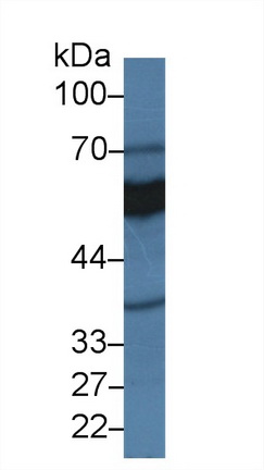 Polyclonal Antibody to Monoamine Oxidase A (MAOA)