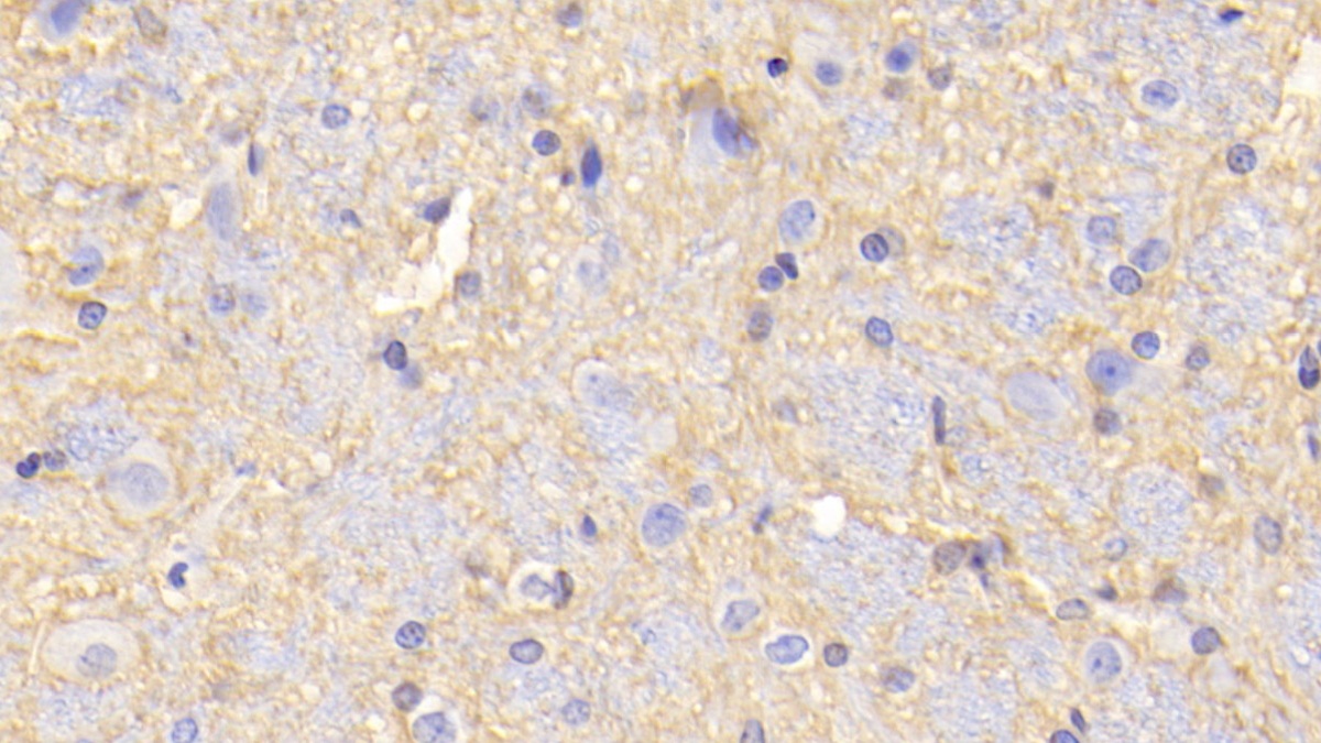 Polyclonal Antibody to Monoamine Oxidase A (MAOA)