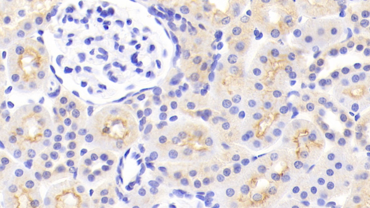 Polyclonal Antibody to Monoamine Oxidase A (MAOA)