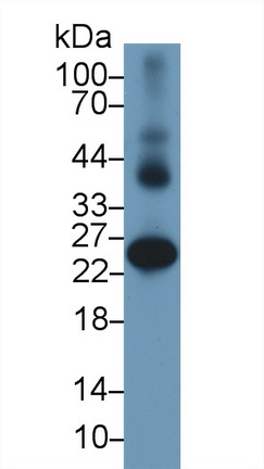 Polyclonal Antibody to Glutathione S Transferase Alpha 2 (GSTa2)