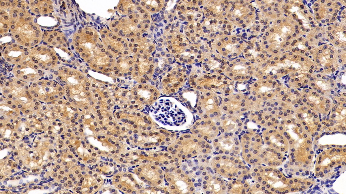 Polyclonal Antibody to Glutathione S Transferase Alpha 2 (GSTa2)