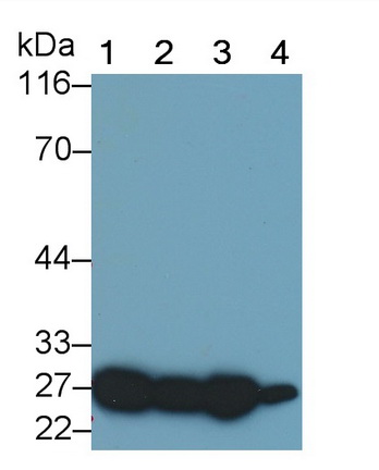 Polyclonal Antibody to Glutathione S Transferase Alpha 2 (GSTa2)