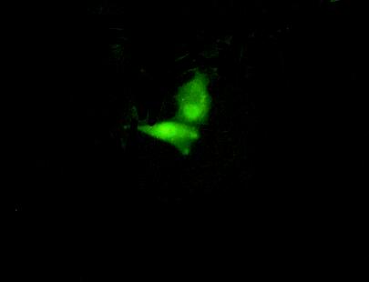 Polyclonal Antibody to Interferon Regulatory Factor 6 (IRF6)