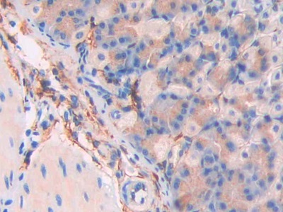 Polyclonal Antibody to Cluster Of Differentiation 34 (CD34)