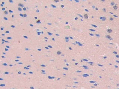 Polyclonal Antibody to Cluster Of Differentiation 34 (CD34)