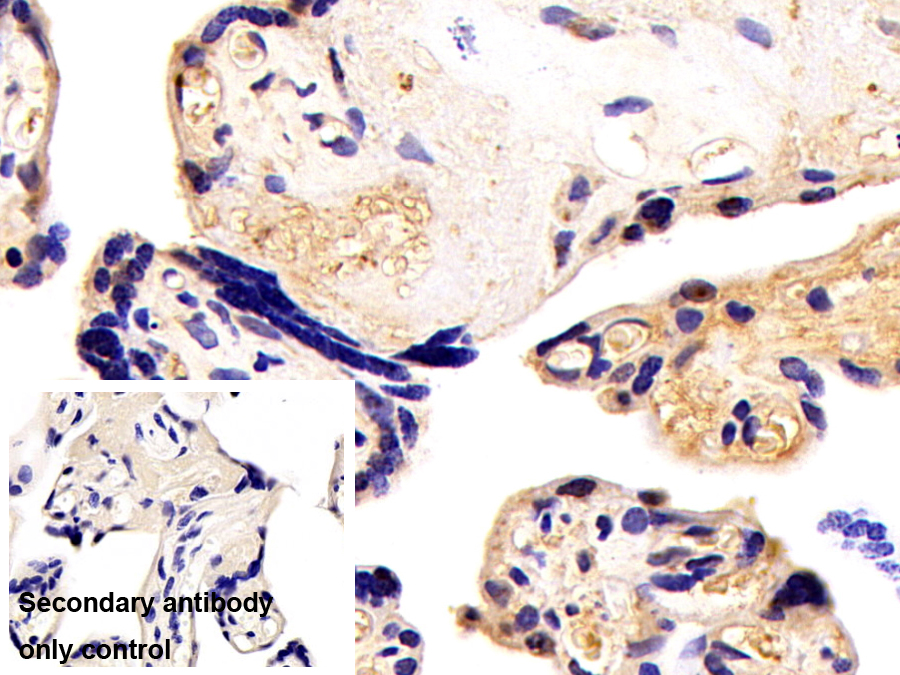 Polyclonal Antibody to Superoxide Dismutase 1 (SOD1)