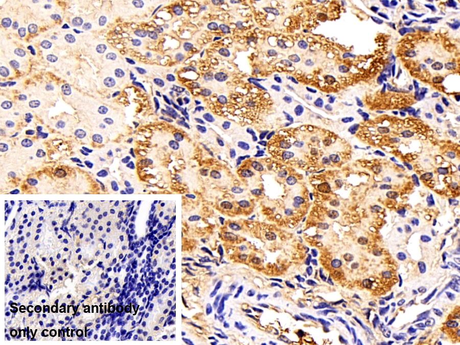 Polyclonal Antibody to Superoxide Dismutase 1 (SOD1)