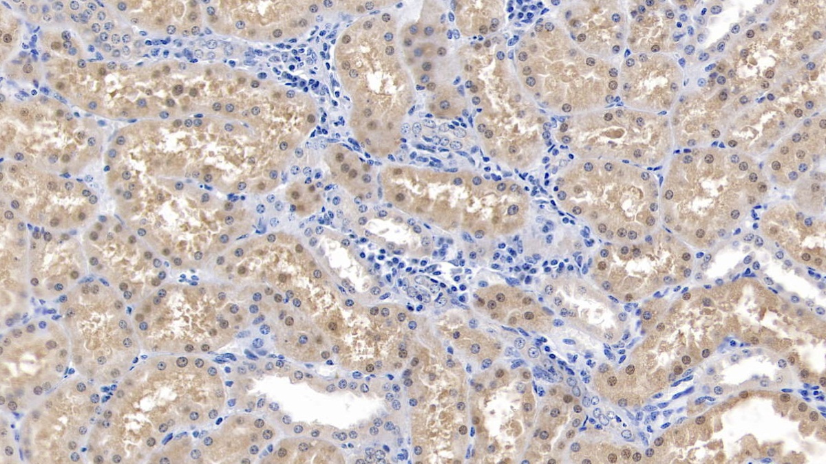 Polyclonal Antibody to Superoxide Dismutase 1 (SOD1)