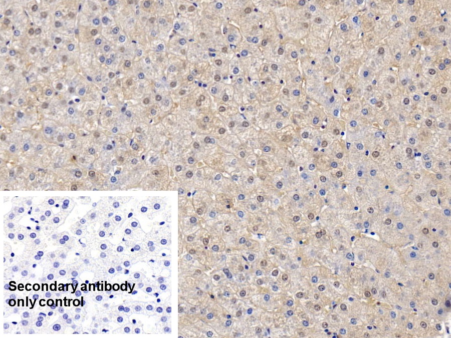 Polyclonal Antibody to Superoxide Dismutase 1 (SOD1)