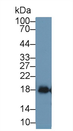 Polyclonal Antibody to Superoxide Dismutase 1 (SOD1)