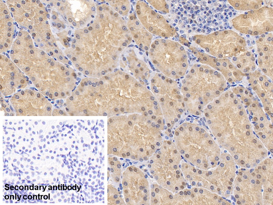 Polyclonal Antibody to Superoxide Dismutase 1 (SOD1)