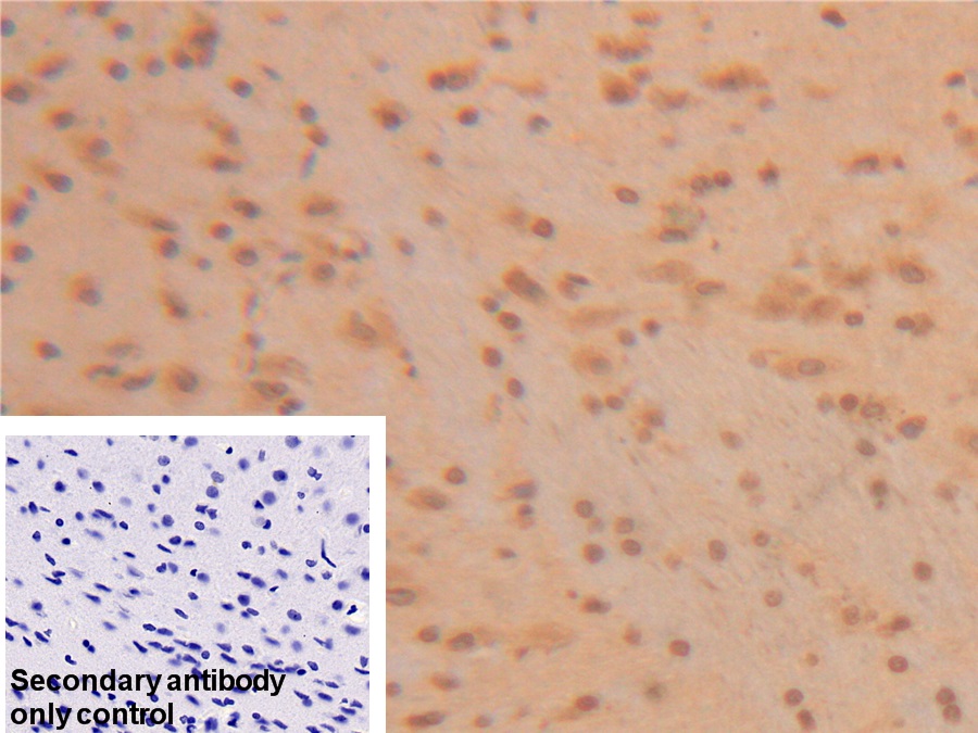 Polyclonal Antibody to Superoxide Dismutase 1 (SOD1)