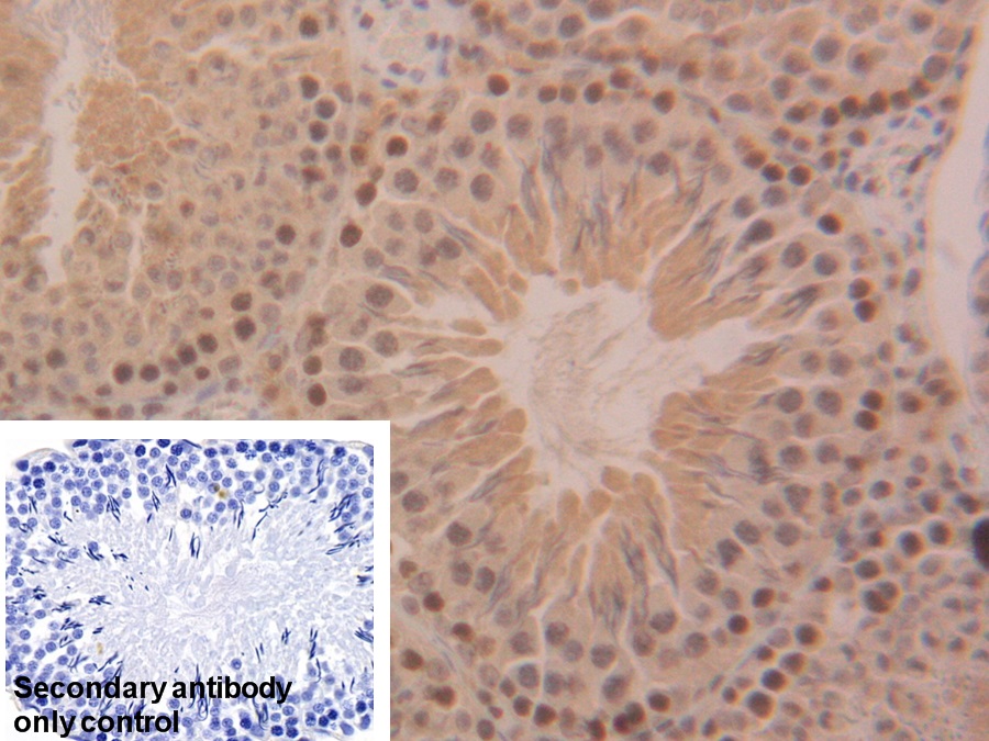 Polyclonal Antibody to Superoxide Dismutase 1 (SOD1)