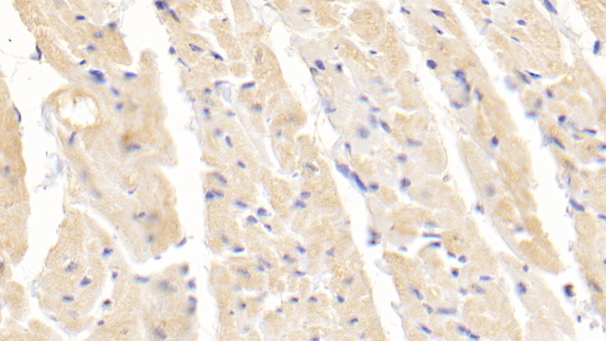 Polyclonal Antibody to Superoxide Dismutase 1 (SOD1)