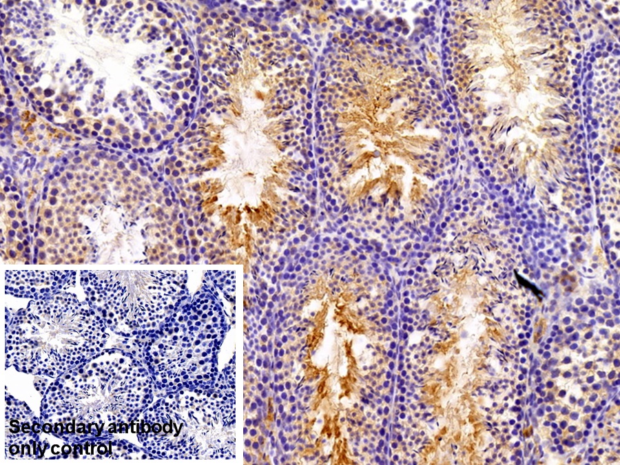 Polyclonal Antibody to Calpain 1 (CAPN1)