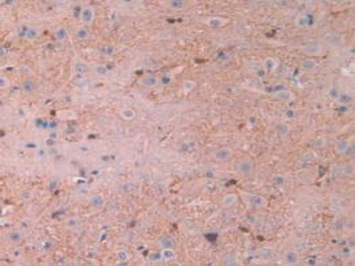 Polyclonal Antibody to Calpain 1 (CAPN1)