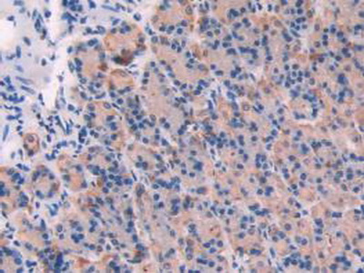 Polyclonal Antibody to Calpain 1 (CAPN1)