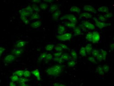 Polyclonal Antibody to Calpain 1 (CAPN1)