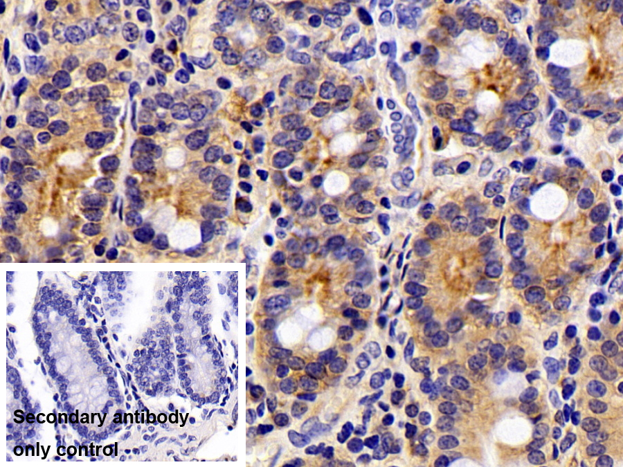 Polyclonal Antibody to Syndecan 1 (SDC1)