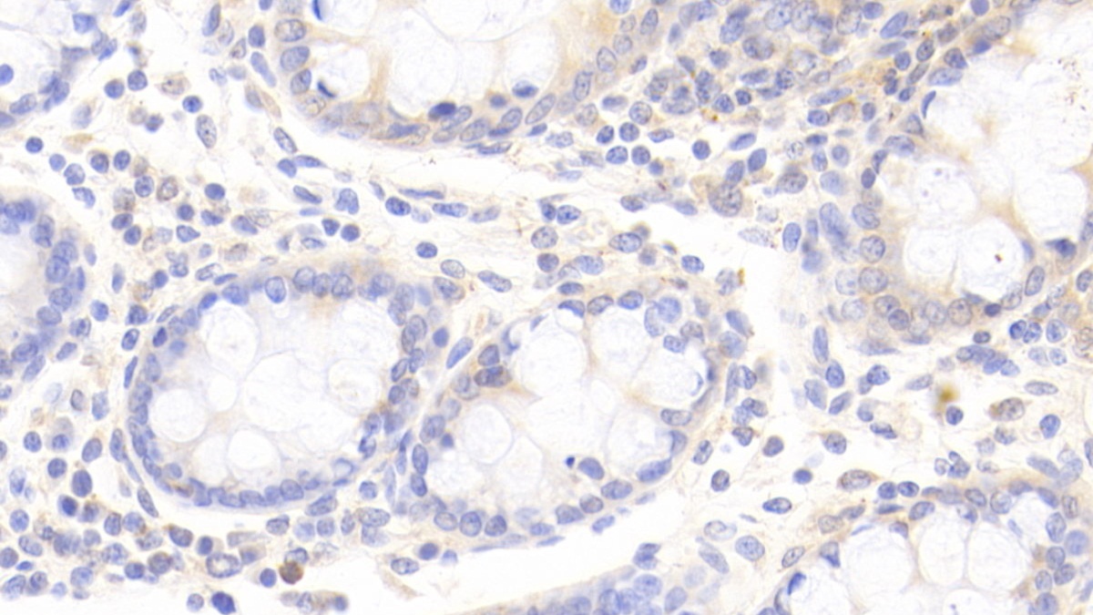 Polyclonal Antibody to Apolipoprotein D (APOD)