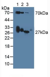 Polyclonal Antibody to Apolipoprotein D (APOD)