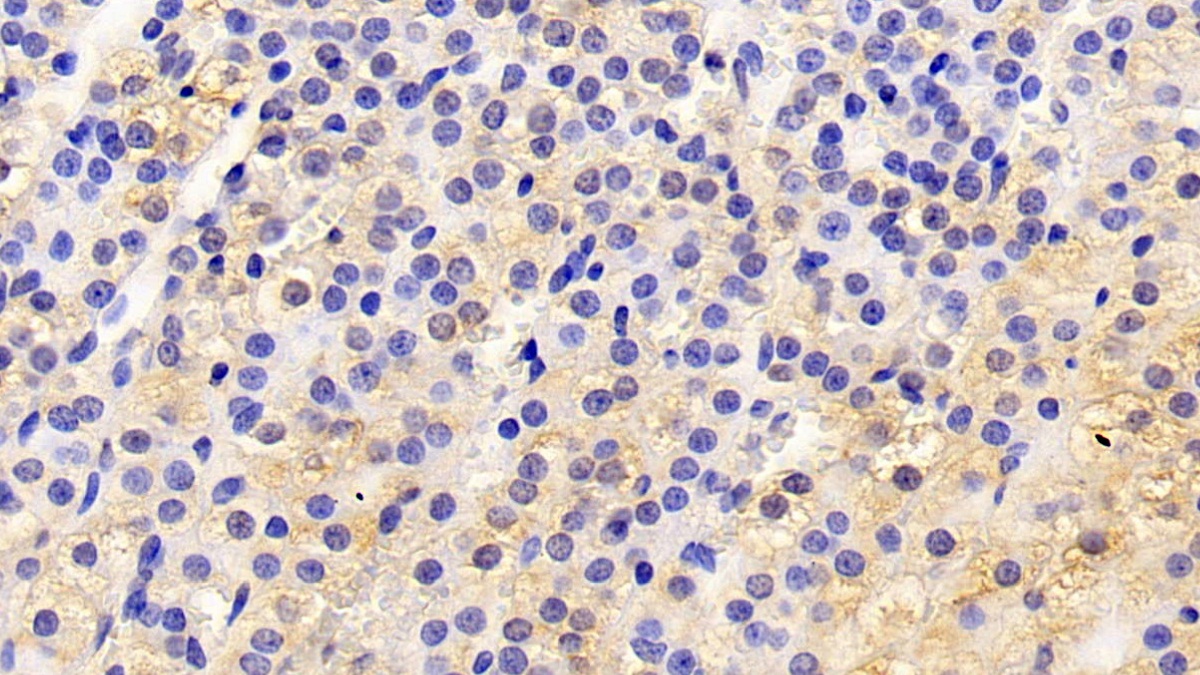 Polyclonal Antibody to Apolipoprotein D (APOD)