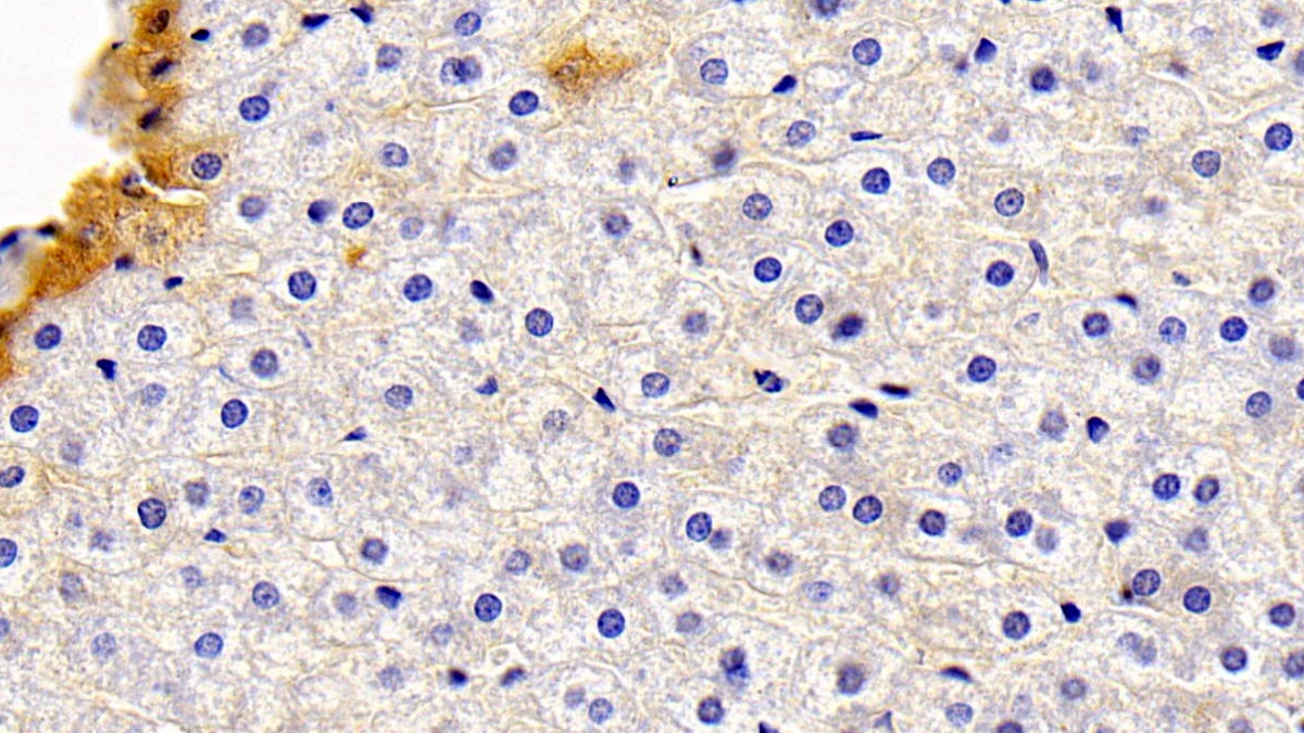 Polyclonal Antibody to Apolipoprotein D (APOD)