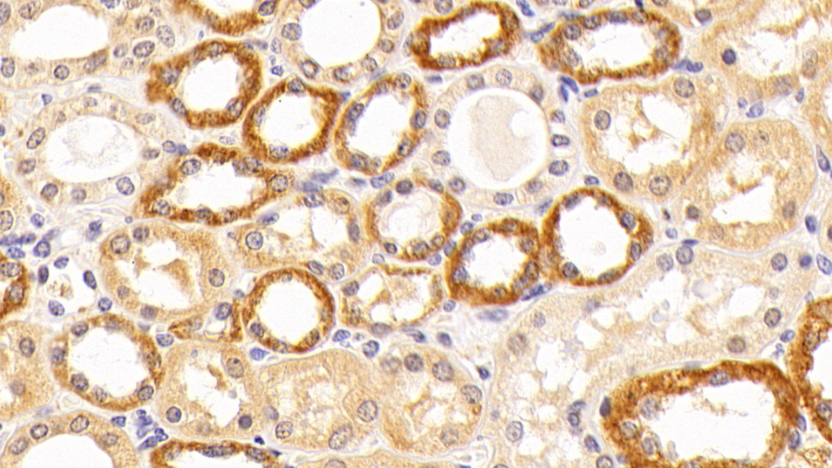 Polyclonal Antibody to Complement Component 5 (C5)