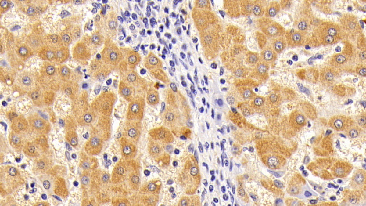 Polyclonal Antibody to Complement Component 5 (C5)