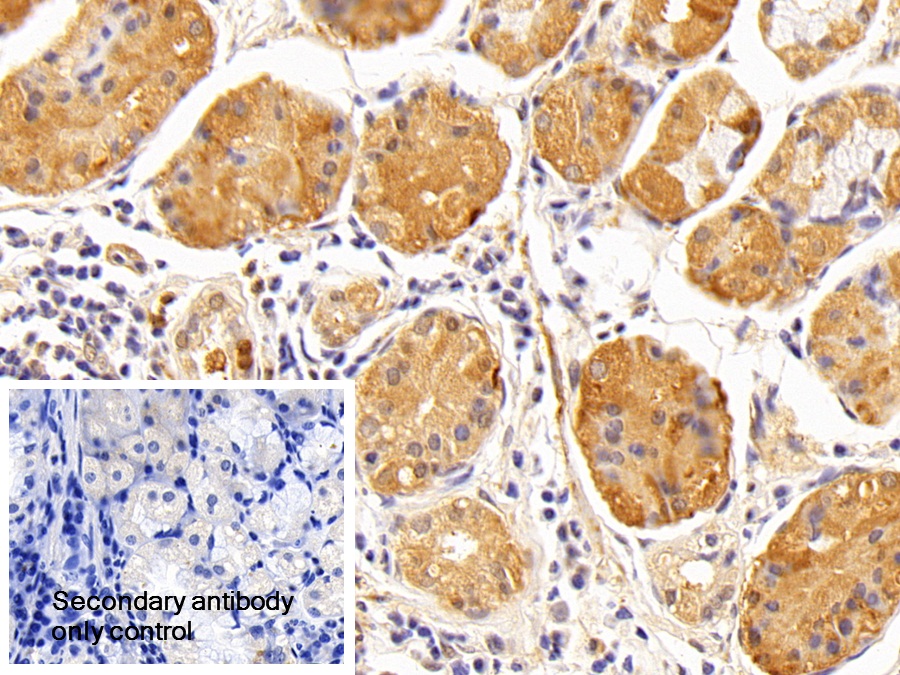 Polyclonal Antibody to Complement Component 5 (C5)