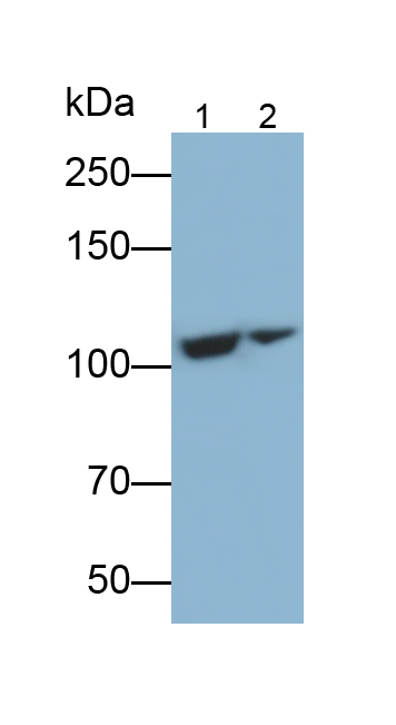 Polyclonal Antibody to Complement Component 5 (C5)