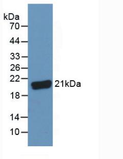 Polyclonal Antibody to Complement Component 8g (C8g)