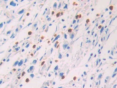 Polyclonal Antibody to Protein S (PROS)