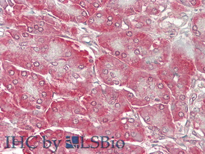 Polyclonal Antibody to Protein S (PROS)