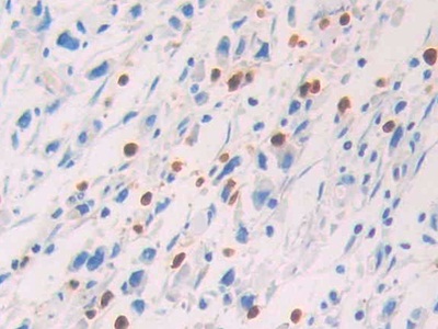 Polyclonal Antibody to Protein S (PROS)