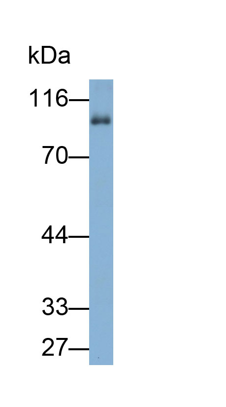 Polyclonal Antibody to A Disintegrin And Metalloproteinase With Thrombospondin 1 (ADAMTS1)