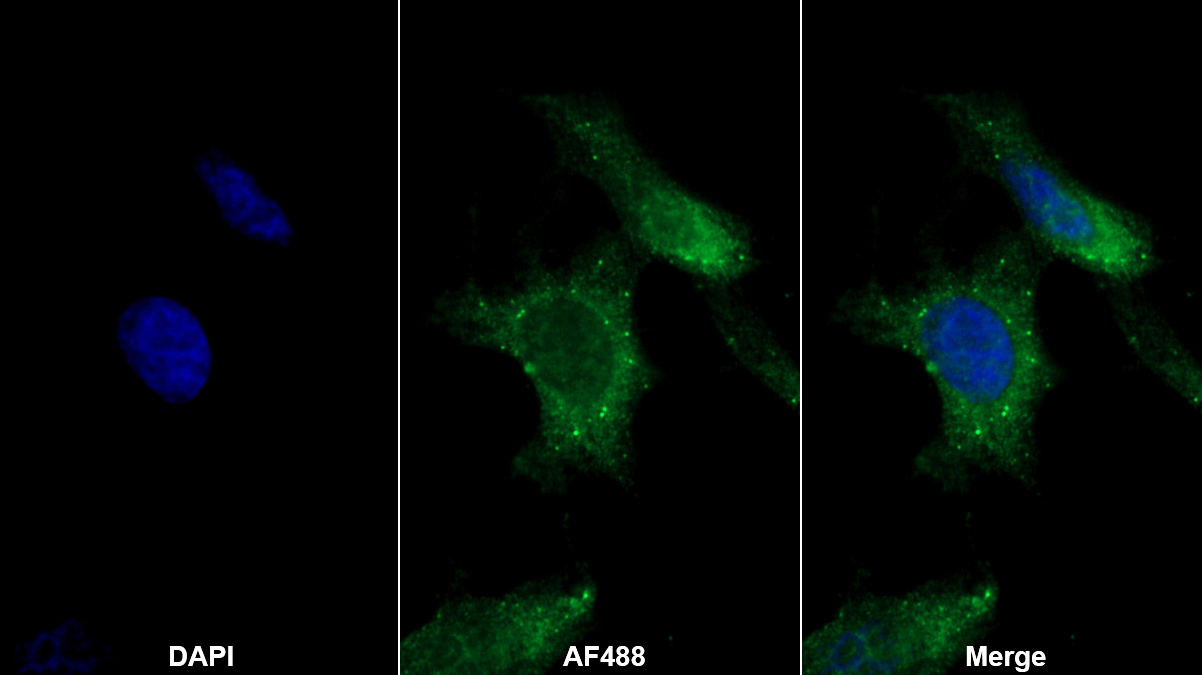 Polyclonal Antibody to A Disintegrin And Metalloproteinase With Thrombospondin 1 (ADAMTS1)