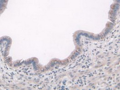 Polyclonal Antibody to A Disintegrin And Metalloproteinase With Thrombospondin 7 (ADAMTS7)