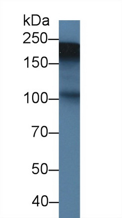 Polyclonal Antibody to Tenascin C (TNC)