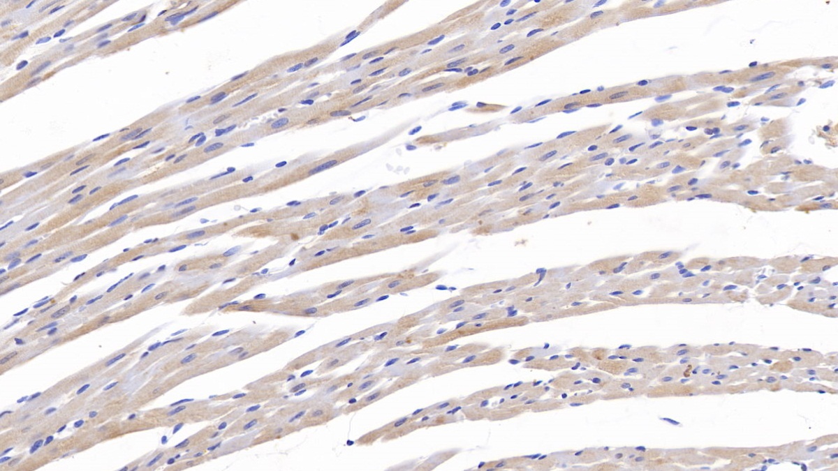 Polyclonal Antibody to Tenascin C (TNC)