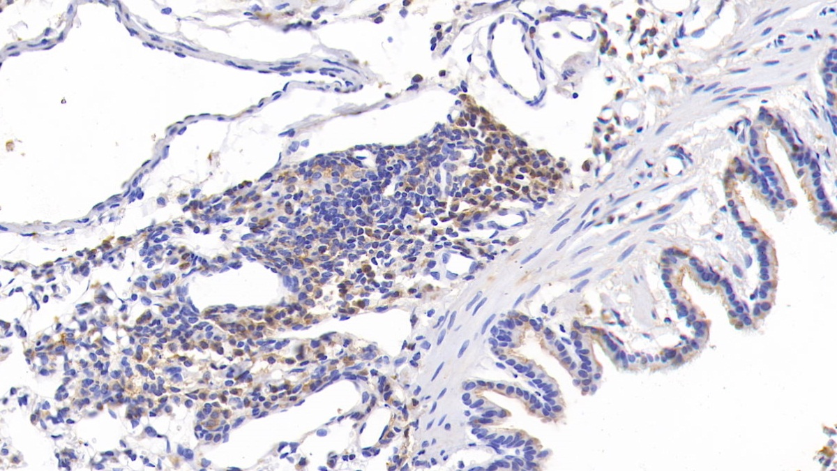 Polyclonal Antibody to Tenascin C (TNC)