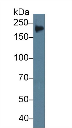 Polyclonal Antibody to Tenascin C (TNC)