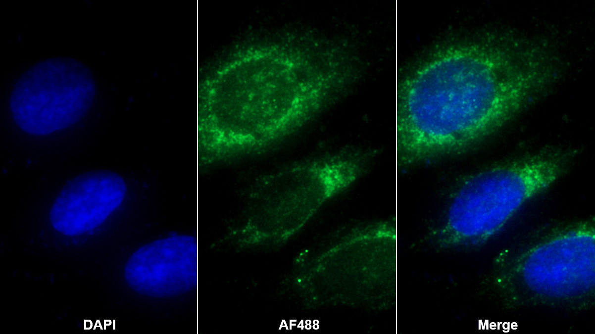 Polyclonal Antibody to Tenascin C (TNC)