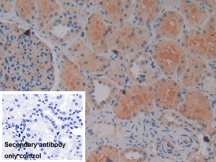 Polyclonal Antibody to Sodium Hydrogen Exchange Regulatory Cofactor 2 (SLC9A3R2)