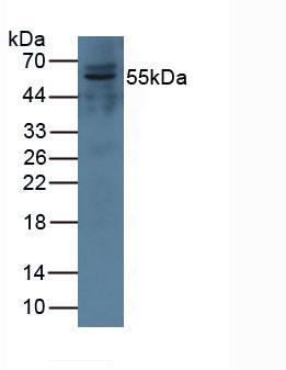 Polyclonal Antibody to Complement Factor I (CFI)