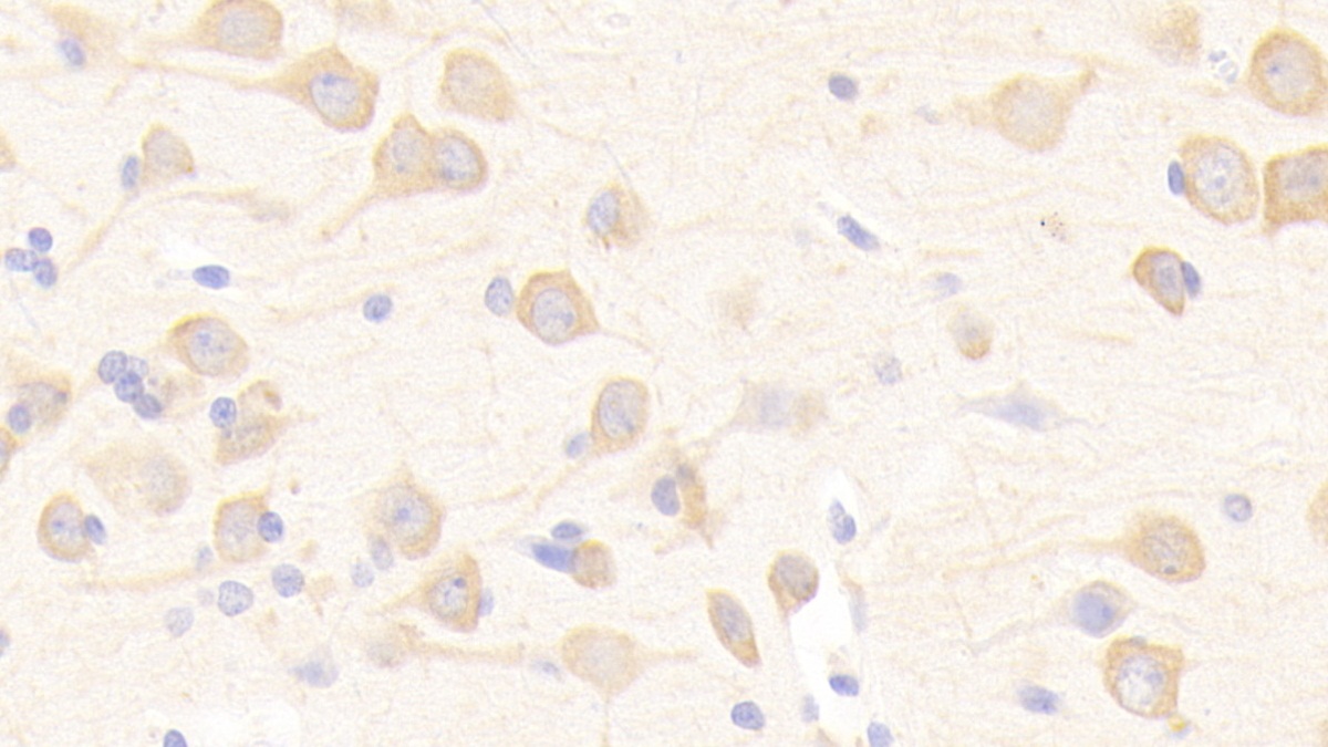 Polyclonal Antibody to Complement Factor I (CFI)