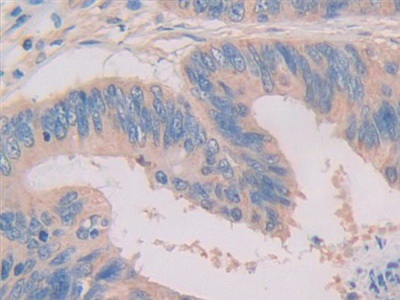 Polyclonal Antibody to Interleukin 33 (IL33)