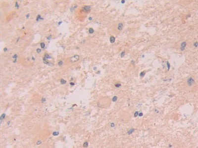 Polyclonal Antibody to Interleukin 33 (IL33)