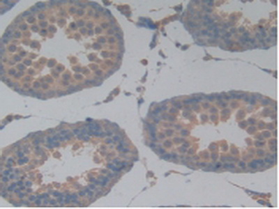 Polyclonal Antibody to Tau Protein (MAPT)